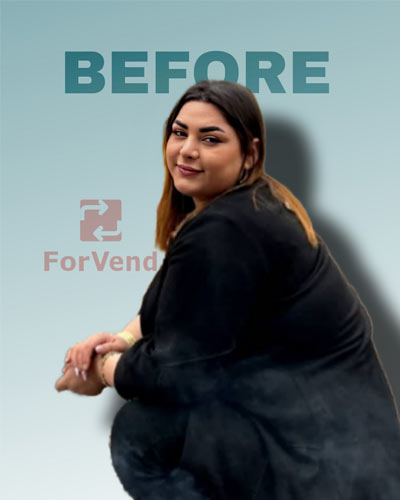 Befor Bariatric Surgery 1