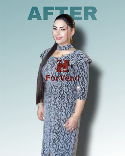 After Bariatric Surgery After Bariatric Surgery